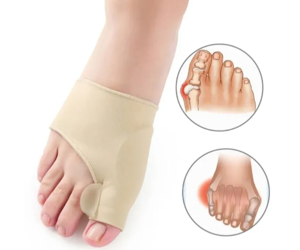 Corrector ortopédico de juanetes - Super Ofertas
