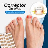 Corrector de Uñas encarnadas - Super Ofertas